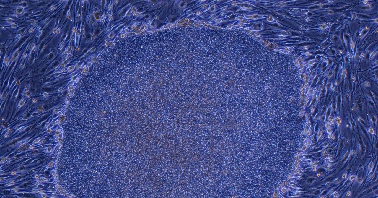 Japão aprova o primeiro tratamento do mundo feito com células humanas reprogramadas